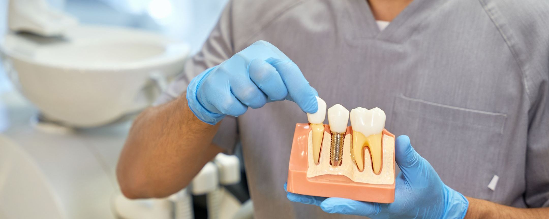 Dental Implant Open Day in Beeston | Saturday 19th September 2026