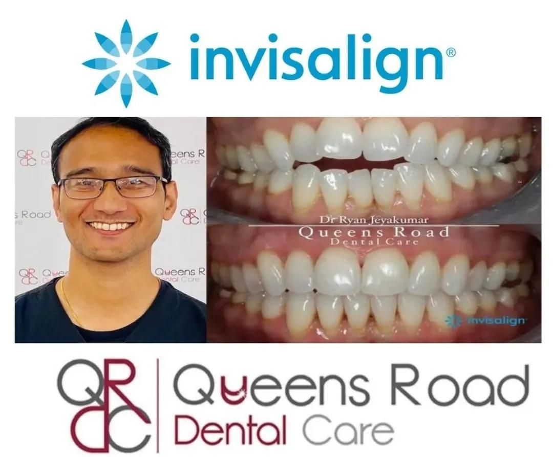 Invisalign at Queens